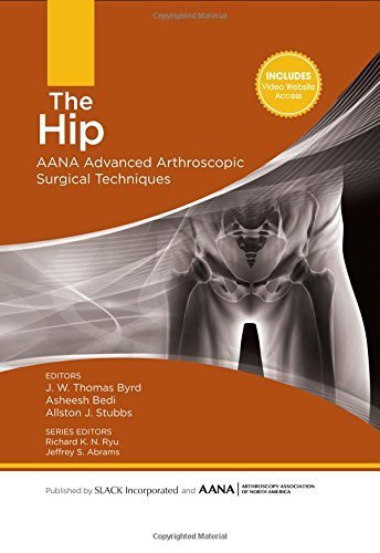 The Hip: AANA Advanced Arthroscopic Surgical Techniques by J.W. Thomas Byrd MD (2015-12-15)