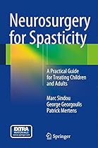 Neurosurgery for Spasticity: A Practical Guide for Treating Children and Adults