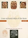 Cross-sectional Atlas of the Brain and DVD