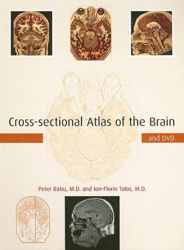 Cross-sectional Atlas of the Brain and DVD
