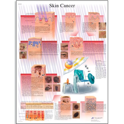skin cancer