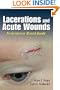 Lacerations and Acute Wounds: An Evidence-Based Guide