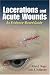 Lacerations and Acute Wounds: An Evidence-Based Guide