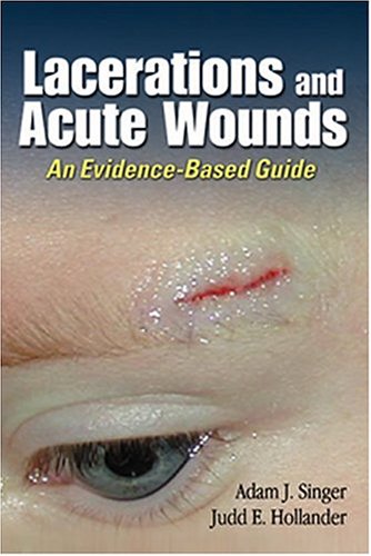 Injuries