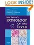 MacSween's Pathology of the Liver: with CD-ROM, 5e
