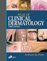 Atlas of Clinical Dermatology