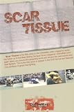Scar Tissue