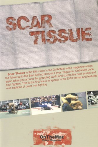 Scar Tissue