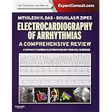 electrocardiography of arrhythmias a comprehensive review a companion to cardiac electrophysiology 1e