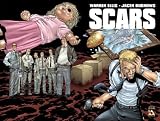 Warren Ellis' Scars