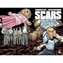 Warren Ellis' Scars