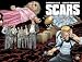 Scars