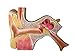 Herindera Causes of Conductive Hearing Loss RS.1500.00