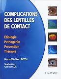 Complications des lentilles de contact : Etiologie, pathog�nie, pr�vention, th�rapie