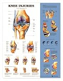 Knee Injuries Anatomical Chart Unmounted-9872PU
