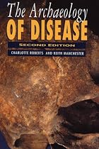 The Archaeology of Disease