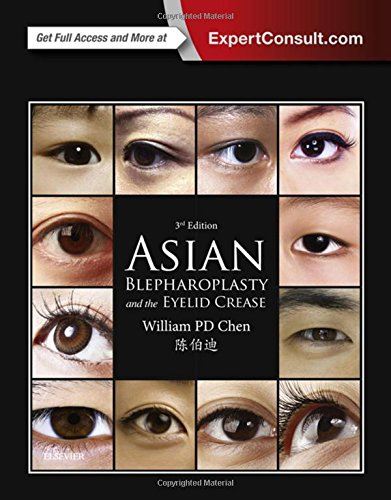 Asian Blepharoplasty and the Eyelid Crease, 3e