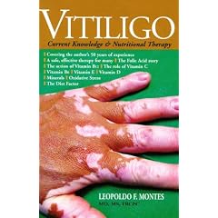 Vitiligo: Current Knowledge & Nutritional Therapy by MD, MS and FRCPC Leopoldo F. Montes