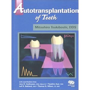 Click here to buy Autotransplantation of Teeth by Mitsuhiro Tsukiboshi, Jens O. Andreasen, Lyasuhiro Asai, and Leif K. Bakland.