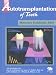 Autotransplantation of Teeth