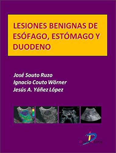 Lesiones benignas de esofágo, estómago y duodeno  (Este capítulo pertenece al libro Tratado de ultrasonografía abdominal) (Spanish Edition)