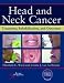 Head and Neck Cancer: Treatment, Rehabilitation, and Outcomes