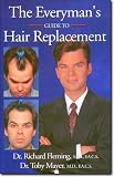 The Everyman's Guide to Hair Replacement