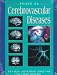 Books : Primer on Cerebrovascular Diseases