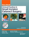 Clinical Practice in Small Incision Cataract Surgery: (Phaco Manual)