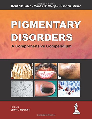 Pigmentary Disorders: A Comprehensive Compendium