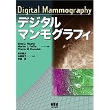 デジタルマンモグラフィ