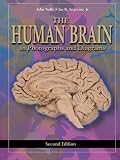 EIC with Animations for the Human Brain, CD-ROM: An Introduction to Its Functional Anatomy: With Select Images from the Human Brain in Photographs and ... the Study Guide to Accompany the Human Brain