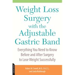 Weight Loss Surgery with the Adjustable Gastric Band: Everything You Need to Know Before and After Surgery to Lose Weight Successfully