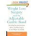 Weight Loss Surgery with the Adjustable Gastric Band: Everything You Need to Know Before and After Surgery to Lose Weight Successfully