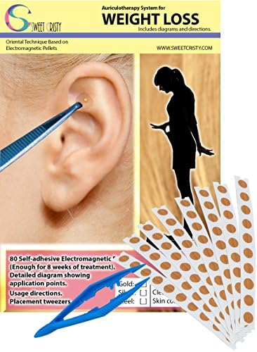 Auriculotherapy System for Weight Loss