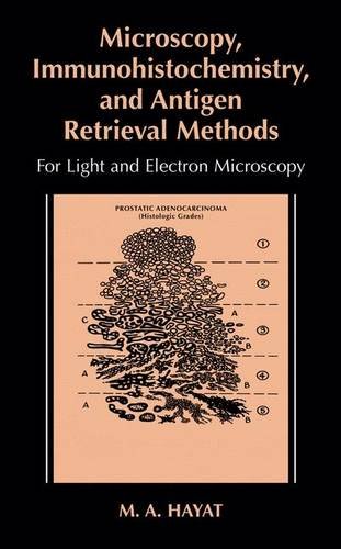 microscopy immunohistochemistry and antigen retrieval methods for light and electron microscopy