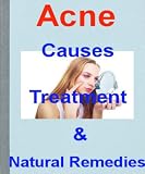 Acne - Causes, Treatment and Natural Remedies