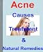 Acne - Causes, Treatment and Natural Remedies