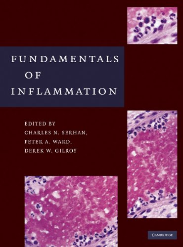 Fundamentals of Inflammation: 0