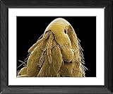 Framed Prints of Cat flea head, SEM from Science Photo Library