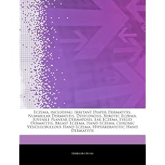Eczema, including: Irritant Diaper Dermatitis, Nummular Dermatitis, Dyshidrosis, Xerotic... by Hephaestus Books