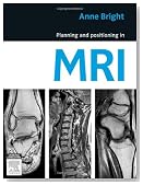 Planning and Positioning in MRI, 1e