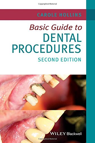 Basic Guide to Dental Procedures (Basic Guide Dentistry Series)