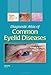 Diagnostic Atlas of Common Eyelid Diseases