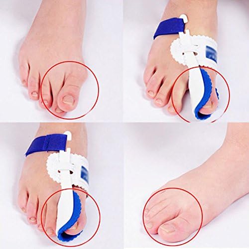 1 Pair Big Toe Bunion Night Splint Straightener Foot Pain Relief Hallux Valgus