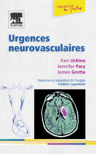 Urgences neurovasculaires (French Edition)