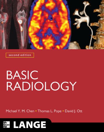 Basic Radiology, Second Edition (LANGE Clinical Medicine) Basic Radiology, Second Edition (LANGE Clinical Medicine)