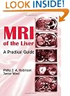 MRI of the Liver: A Practical Guide
