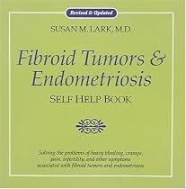 Fibroid Tumors and Endometriosis