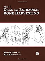Atlas of Oral and Extraoral Bone Harvesting Atlas of Oral and Extraoral Bone Harvesting